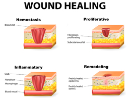 Nutritional Support for Injury and Wound Healing - The Paleo Mom