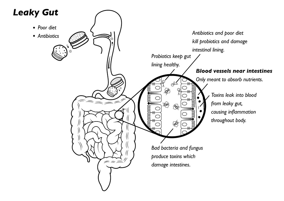 leaky_gut